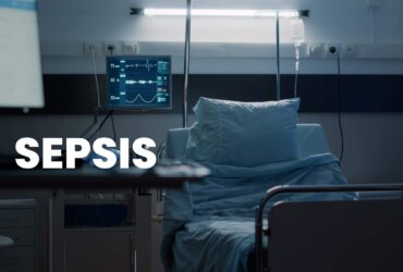 Sepsis