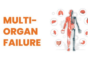 Multiorgan Failure & the Role of ICU Treatments