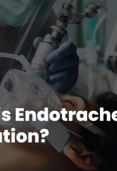 What is Endotracheal Intubation?