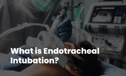 What is Endotracheal Intubation?